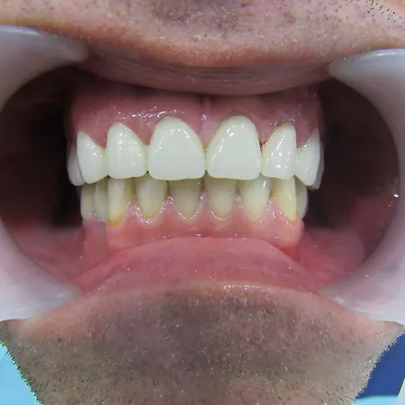 Serenity טיראנה