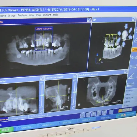 מלון Serenity טיראנה