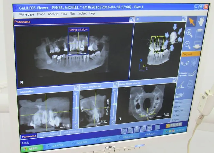 Hotell Serenity Tirana